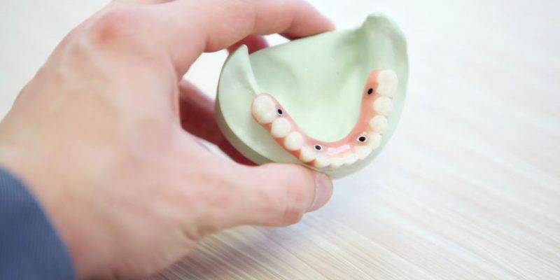 Hvad er implantater?
